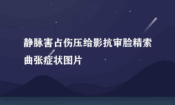 静脉害占伤压给影抗审脸精索曲张症状图片