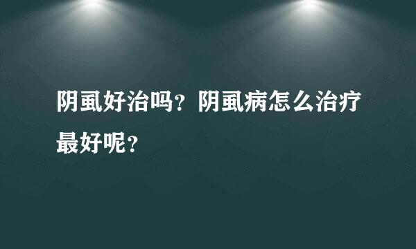 阴虱好治吗？阴虱病怎么治疗最好呢？