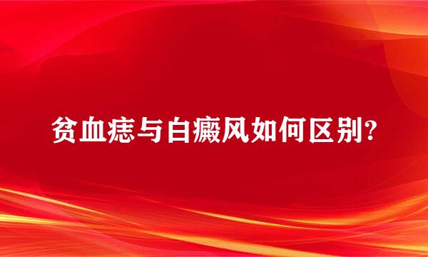 贫血痣与白癜风如何区别?