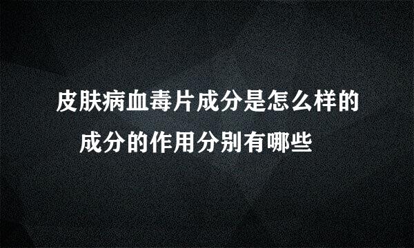 皮肤病血毒片成分是怎么样的 成分的作用分别有哪些