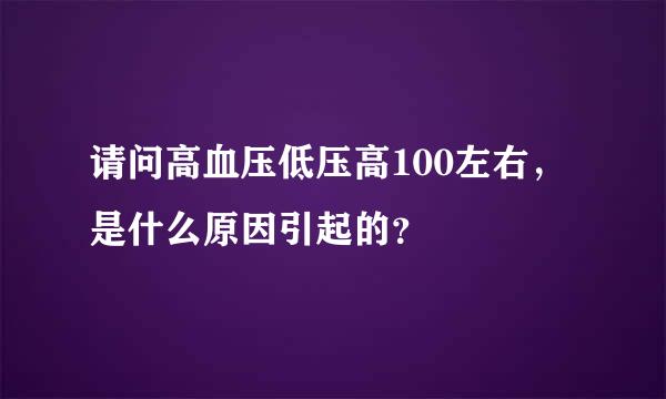 请问高血压低压高100左右，是什么原因引起的？