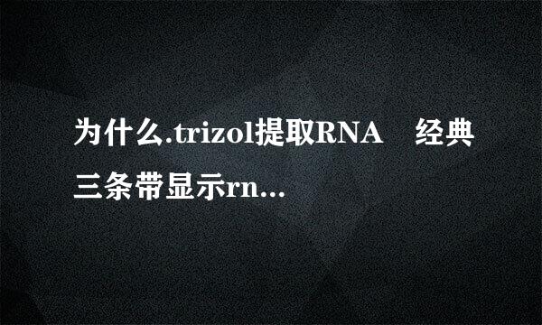 为什么.trizol提取RNA 经典三条带显示rna完整性