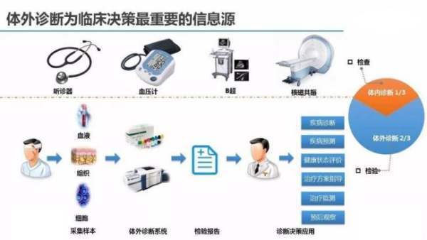 ivd是什来自么意思？