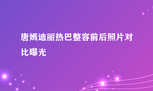 唐嫣迪丽热巴整容前后照片对比曝光