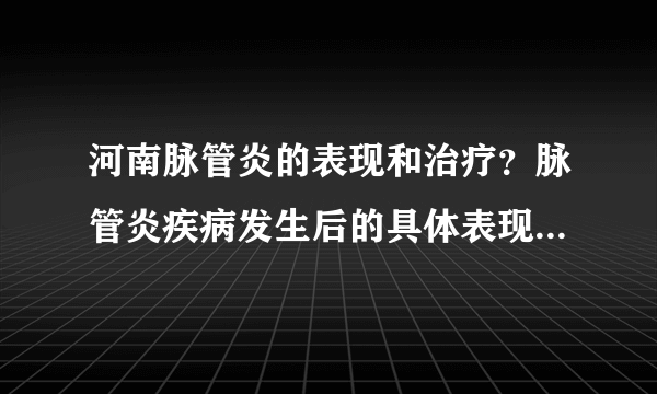 河南脉管炎的表现和治疗？脉管炎疾病发生后的具体表现是什么？