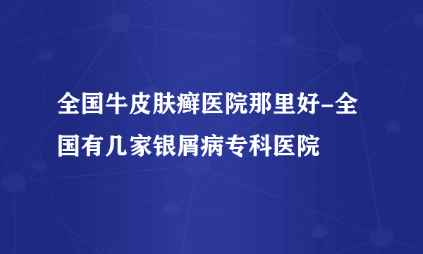 全国牛皮肤癣医院那里好-全国有几家银屑病专科医院