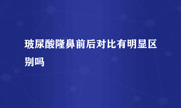 玻尿酸隆鼻前后对比有明显区别吗