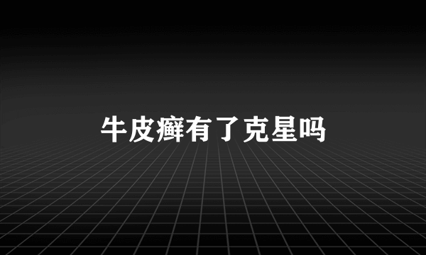 牛皮癣有了克星吗