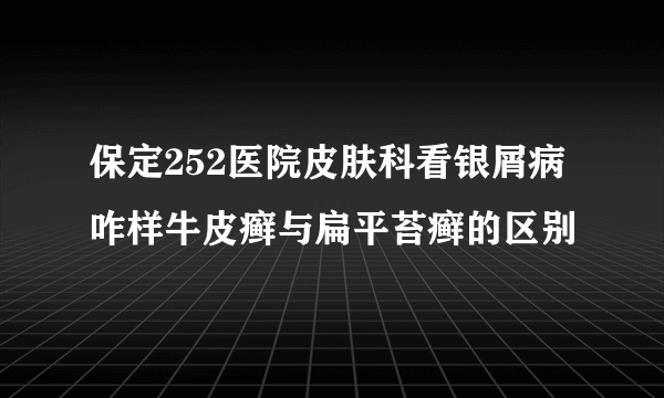 保定252医院皮肤科看银屑病咋样牛皮癣与扁平苔癣的区别