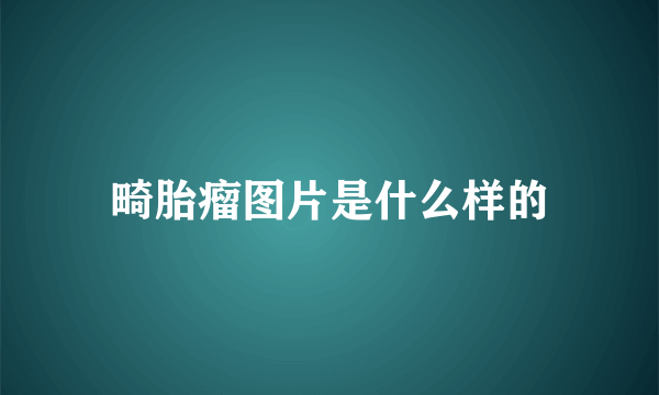 畸胎瘤图片是什么样的