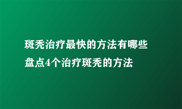 斑秃治疗最快的方法有哪些 盘点4个治疗斑秃的方法