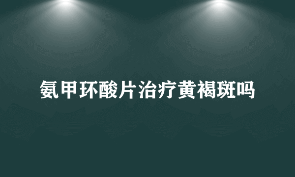 氨甲环酸片治疗黄褐斑吗