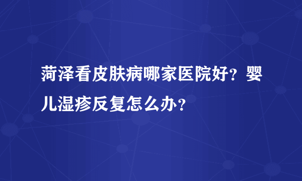 菏泽看皮肤病哪家医院好？婴儿湿疹反复怎么办？